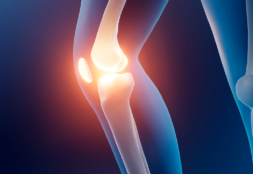 반월상 연골판 파열 